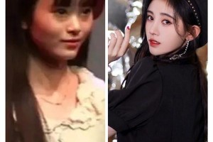 鞠婧祎陈小纭等明星五官修整成功案例解析